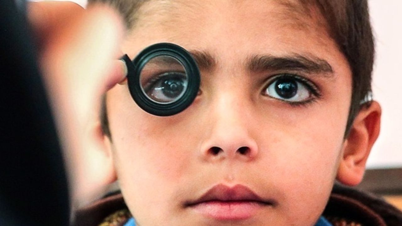 کاهش دید دائم با تشخیص دیرهنگام تنبلی چشم